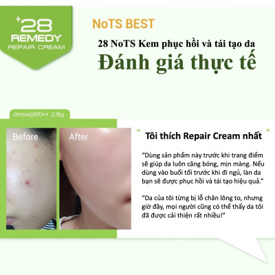 KEM DƯỠNG DA NOTS 28 REMEDY REPAIR CREAM