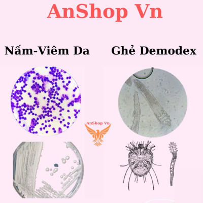 Nhỏ Gáy Fronil Và Viên Nhai Eto Modex Diệt Ve Ghẻ, Nấm Nặng, Rận Bọ Chét Cho Chó Mèo