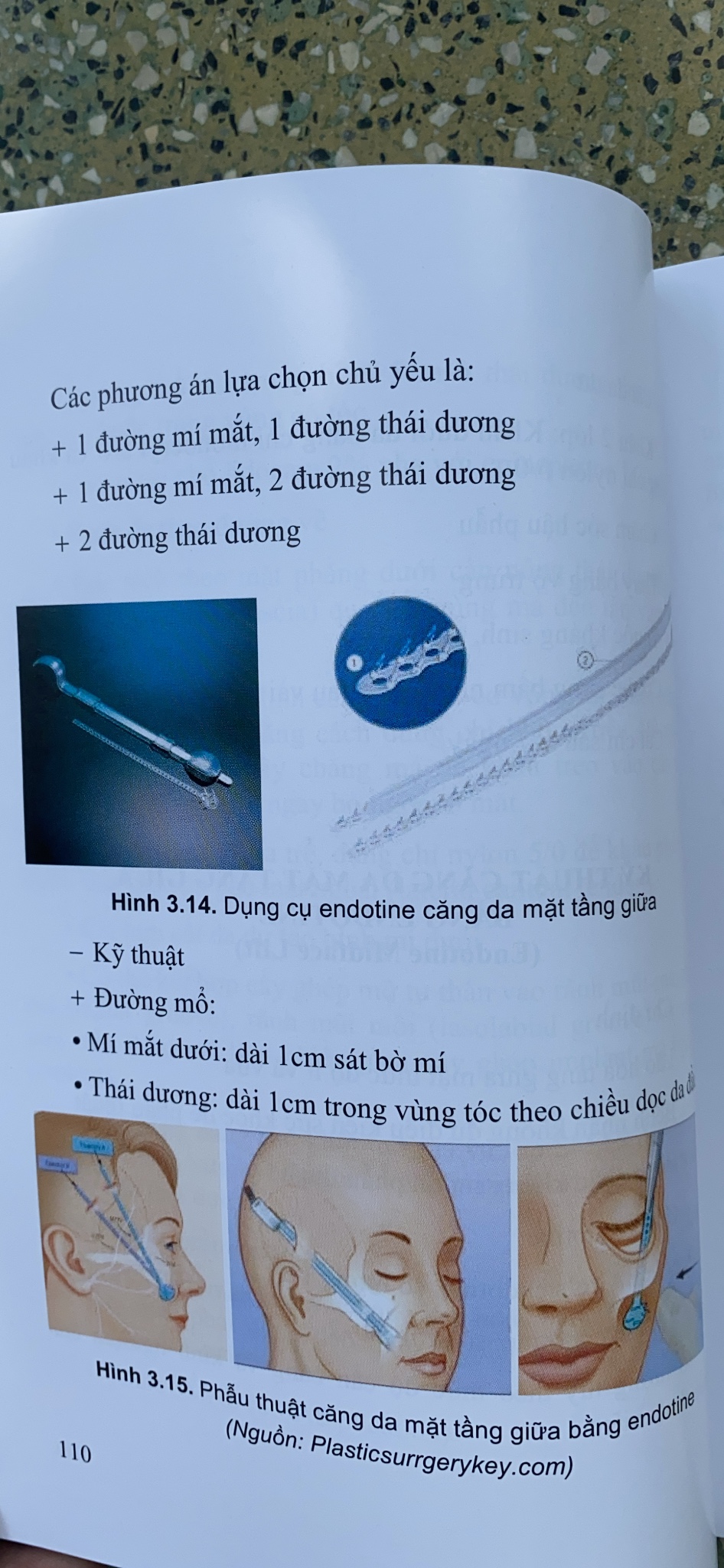Sách - Tạo hình thẩm mỹ Đầu - Mặt - Cổ & Mông - Chân - Tay