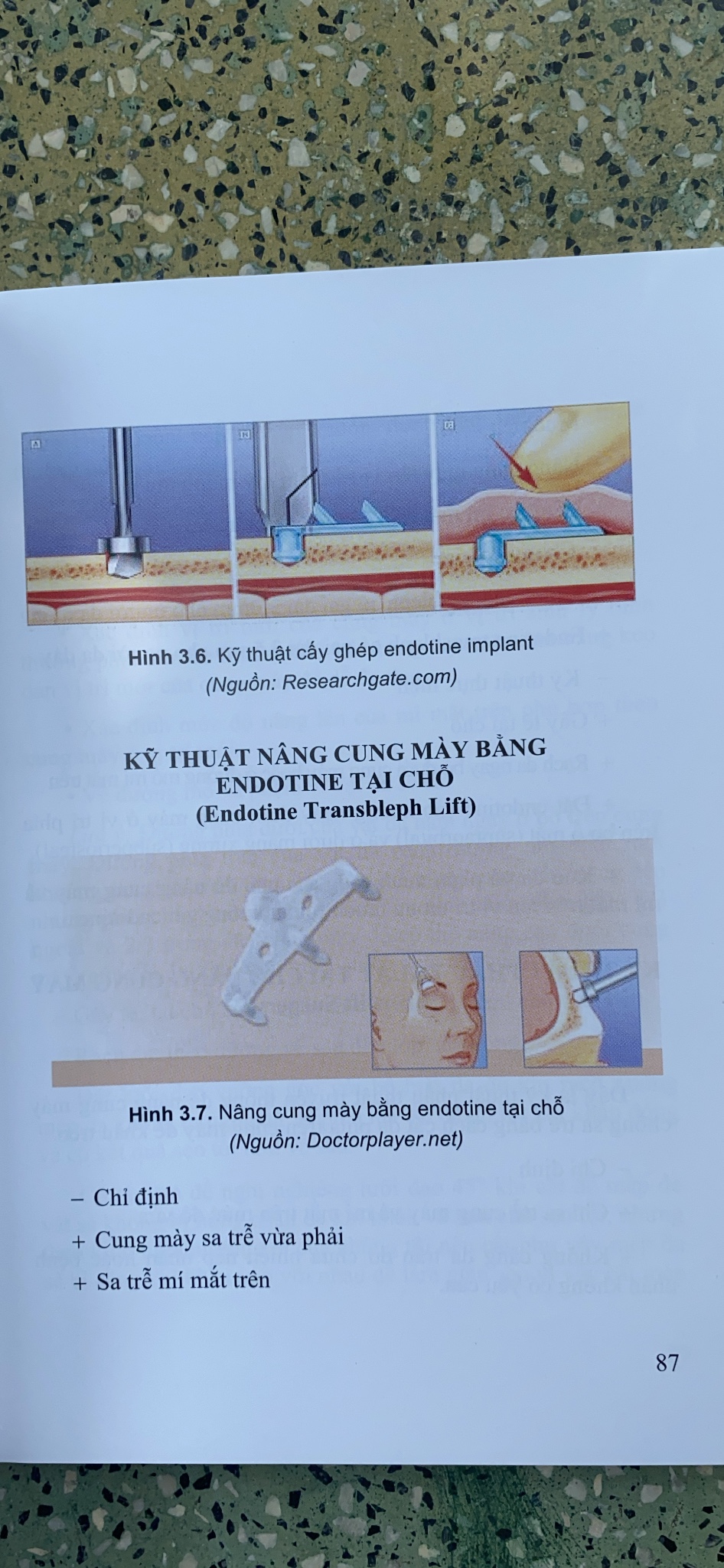 Sách - Tạo hình thẩm mỹ Đầu - Mặt - Cổ & Mông - Chân - Tay