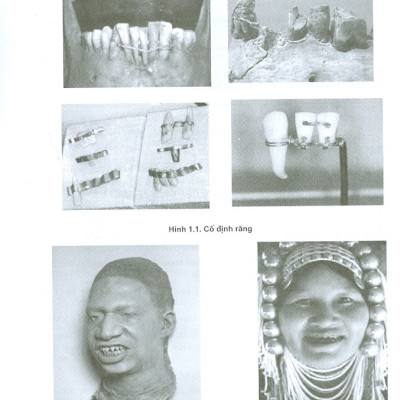 Phục Hình Răng Cố Định (Dùng Cho Sinh Viên Răng Hàm Mặt)