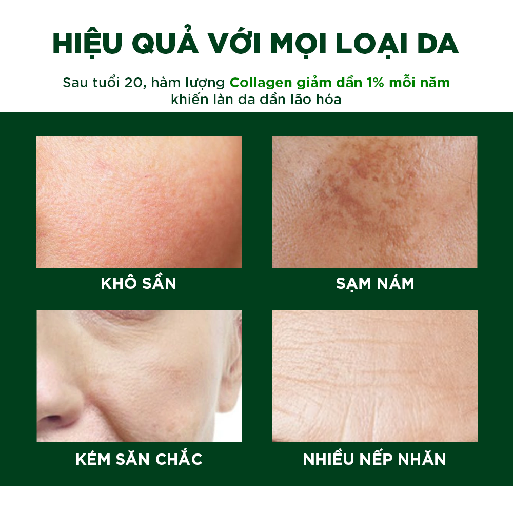 Combo 3 Viên Uống Đẹp Da Oribe Hỗ Trợ Sáng Da Mờ Thâm Nám Hộp 30 viên