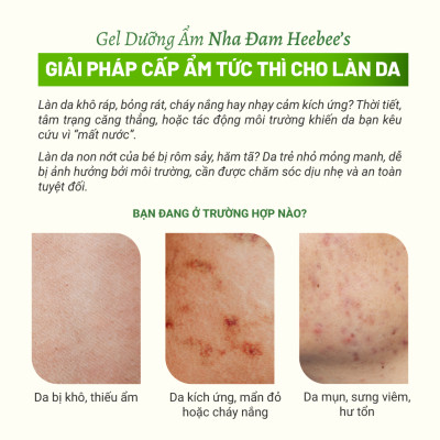 Gel Dưỡng Ẩm Thuần Chay Nha Đam Heebee