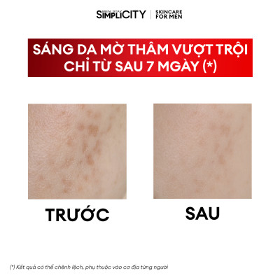 Bộ sản phẩm Men Stay Simplicity sáng da, mờ thâm cho nam: Sữa rửa mặt 100g + Vital Serum sáng da 30ml + Kem dưỡng ẩm 80g