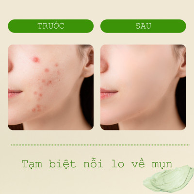 Mặt Nạ Đất Sét Rau Má Ngừa Mụn Mịn Da POP