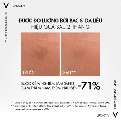Tinh chất giúp cải thiện & ngăn ngừa thâm nám đốm nâu Vichy Liftactiv B3 dark spots 30ml