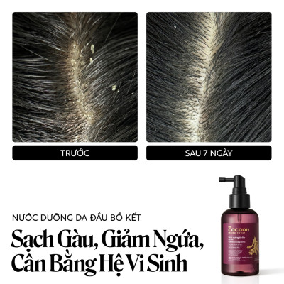 Nước dưỡng da đầu bồ kết Cocoon giảm gàu và chăm sóc da đầu nhạy cảm 140ml
