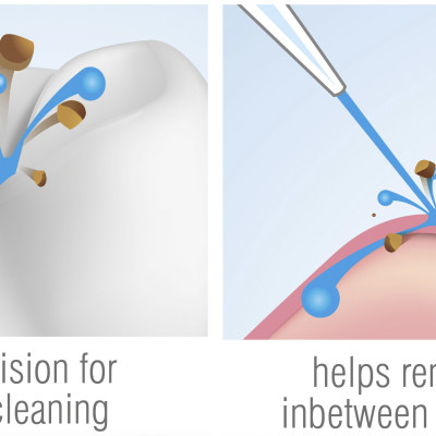 Máy tăm nước cầm tay du lịch nhập khẩu chính hãng Vương quốc Anh RIO - DCIR2