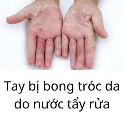 Găng Tay Cao Su Tự Nhiên Hàn Quốc Thương Hiệu BEIGL Có Móc Đủ Kích Cỡ