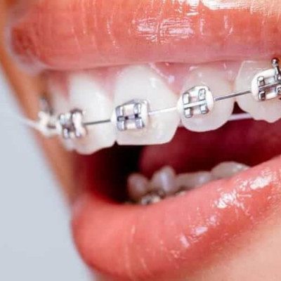 Cuộn chỉ nha khoa Lion Clinica Advantage 40m làm sạch các mảng bám giữa kẽ răng & ngăn ngừa các bệnh lý về răng miệng - Made in Japan