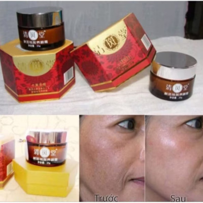 HỘP KEM TRỊ HẾT NÁM TÀN NHANG DA THÂM SẠM NHẬT BẢN HÀNG CHUẨN