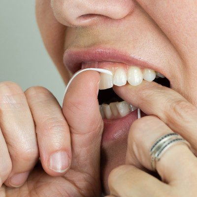 Chỉ nha khoa hương bạc hà Tepe Dental Floss 5m (cuộn 5m)