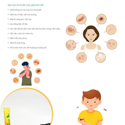 Kem bôi da thuần mộc kem bôi nấm ngứa Thanh Mộc Hương 16gr