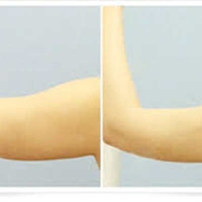 TINH DẦU MASSAGE THIÊN NHIÊN THON GỌN VÓC DÁNG MẸ KEN 100ml